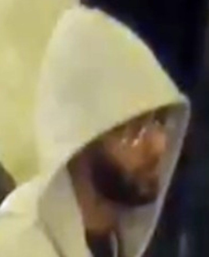 robbery-assault suspect